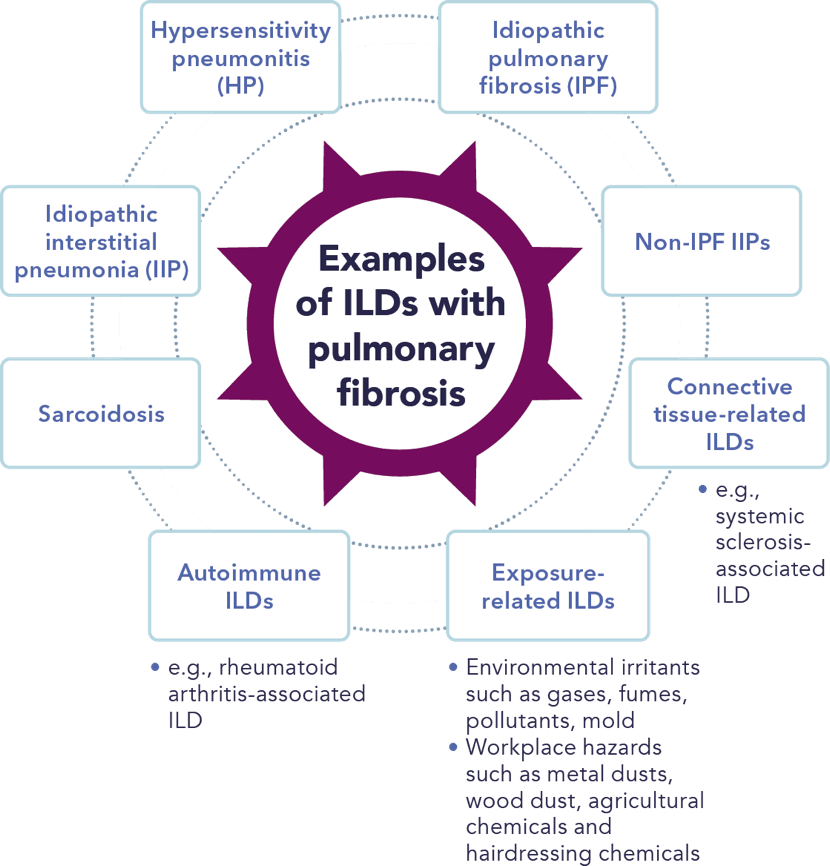 A circular diagram showing many iLDs are associated with pulmonary fibrosis.