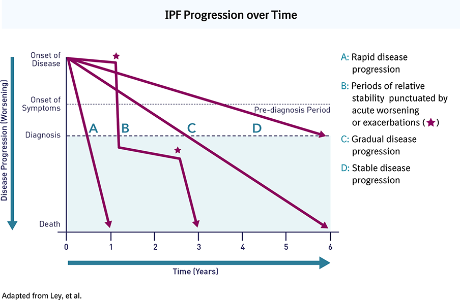 A graph showing IPF progression over time.